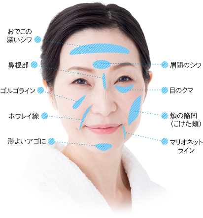 Ozumi オズミ クリニック 福岡 北九州 小倉 美容外科 形成外科 美容皮膚科 メディカルエステ アンチエイジング 自家組織による肌の若返り 再生医療 Ozumi オズミ クリニック 福岡 北九州 小倉 美容外科 形成外科 美容皮膚科 メディカルエステ アンチエイジング 自家組織による肌の若返り 再生医療